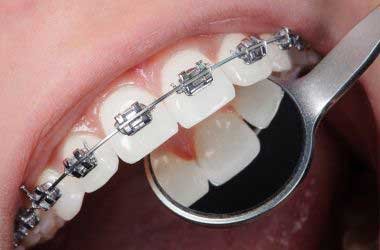 Oral Health in Australia - Orthodontics