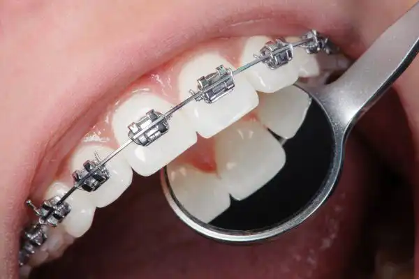 orthodontics