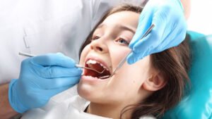 Importance of Dental Sealants