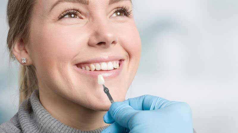 Are dental veneers reversible