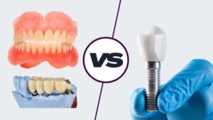 Dental Implants vs. Other Restorative Options